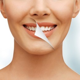 Скидка 30% на комплекс : гигиена полости рта + отбеливание зубов!