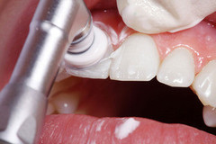  Скульптура Чарли Гигиена полости рта